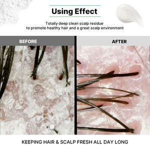 <span class=keywords><strong>แชมพู</strong></span>สระผมและครีมนวดหนังศีรษะสำ<span class=keywords><strong>ห</strong></span><span class=keywords><strong>รับ</strong></span>ผู้ชายที่ดีที่สุดในแต่ละวันแบบ2 in 1สำ<span class=keywords><strong>ห</strong></span><span class=keywords><strong>รับ</strong></span>ระบายความร้อนอย่างรวดเร็วตามธรรมชาติและป้องกันรังแคแชมพู - Product Image 3