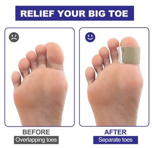 Correcteur d'Hallux Valgus en Gel de Silicone Réglable Séparateur d'Orteils Attelle Redresseur Orthopédique Soulagement de la Douleur Soins des Pieds - Product Image 4
