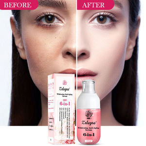 Suero Blanqueador y Antienvejecimiento Zaleyae <span class=keywords><strong>Rose</strong></span> 6 en 1, Antiarrugas, Atenúa Líneas Finas, Hidratante, Repara la Piel Opaca, Esencia para el Cuidado Facial, 50 ml - Product Image 1