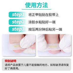 Corrector de uñas encarnadas Cofoe, parche para ranura de uñas, 10 parches de plástico y acero inoxidable para la población en general - Product Image 3