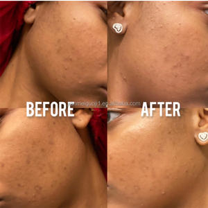 Tranexaminezuur En Niacinamide Gezichtsserum Met Hyaluronzuur Verkleuring Corrigerend Middel Gericht Op Donkere Vlekken - Product Image 4