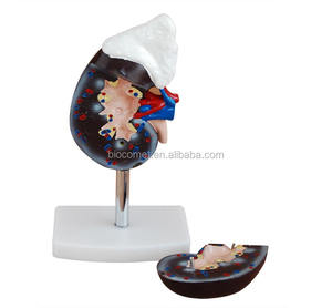 Modelo de riñón humano (2 partes) Modelo anatómico de riñón de entrenamiento escolar de hospital - Product Image 4