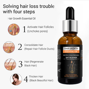 Olio <span class=keywords><strong>per</strong></span> la Crescita dei <span class=keywords><strong>Capelli</strong></span> con Formula Naturale, Etichetta Privata Personalizzata, Siero Nutriente <span class=keywords><strong>per</strong></span> il Cuoio Capelluto, Olio Organico <span class=keywords><strong>per</strong></span> Rapido Infoltimento dei <span class=keywords><strong>Capelli</strong></span> - Product Image 3