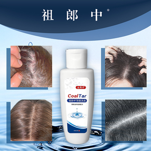 Shampooing au goudron de houille <span class=keywords><strong>Lotion</strong></span> pelliculaire Bactériostase Démangeaisons Antipelliculaires - Product Image 5