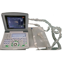 Offre Spéciale Échographe Portable Ordinateur Portable Système de Diagnostic Ultrasonore Appareil d'Échographie Médicale