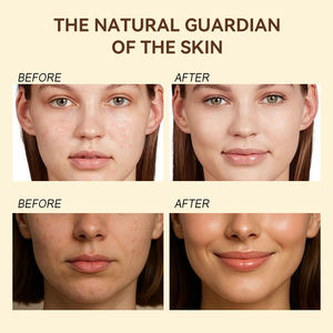 Bálsamo de Sebo Batido Personalizado, Orgánico, a Base de Hierbas, con Aceite de Oliva y Vitamina E, Cruelty-Free, Hidratante, Suavizante y Antioxidante, Crema Facial - Product Image 6