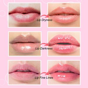 Mascarilla Labial Hidratante y Blanqueadora de Marca Privada, Colágeno, Ácido Hialurónico en Polvo, Parches Labiales de Cristal Rosa, Aroma a Melocotón - Product Image 4