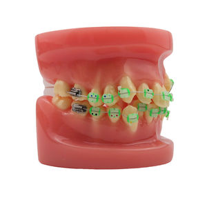 Modelo de Demostración de Ortodoncia para Educación Dental con 28 Piezas de Dientes y Brackets de Cerámica - Product Image 6