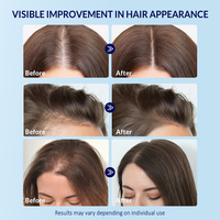 NUEVO Aceite para el Crecimiento del Cabello con Péptidos de Cobre Azul GHK-Cu, Suero para el Cuero Cabelludo para Cabello Fino, OEM ODM Marca Privada