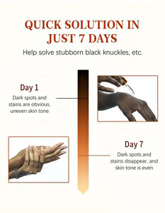 Nudillos oscuros, suero blanqueador rápido, correctores <span class=keywords><strong>de</strong></span> pigmentación, codos <span class=keywords><strong>de</strong></span> mano, removedor <span class=keywords><strong>de</strong></span> <span class=keywords><strong>manchas</strong></span> intensas <span class=keywords><strong>de</strong></span> rodilla, suero para piel oscura - Product Image 5