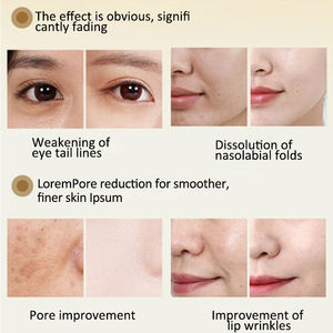 OEM/ODM Cilt Canlandırıcı Esans - Aobenchu Orman Nefesi Derin Nemlendirme Onarım Özel Etiketli Cilt Bakım Ürünleri Fabrikası - Product Image 3