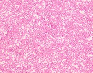 Set di 15 Preparati Microscopici di Celle Ematiche Umane per Citologia <span class=keywords><strong>Standard</strong></span>, per l'Insegnamento nelle Scuole Medie - Product Image 3