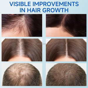Natural Organic Rosemary Essential Oil Hair Growth Serum Hair <strong>Regeneration</strong> Treatment <strong>Scalp</strong> Care Massage <strong>Scalp</strong> Hair Care Oil - Product Image 6