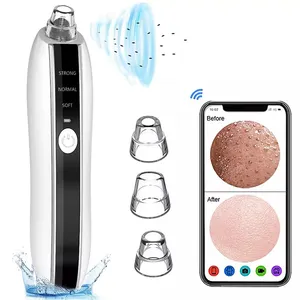 300,000 High-definition Pixel Vacuum Blackhead Remover Accurately Absorbs Blackheads And Acne Pore Purifier