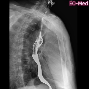 Appareil de radiographie clinique série IND, système de radiographie numérique dynamique/fluoroscopie pour hôpital - Product Image 5