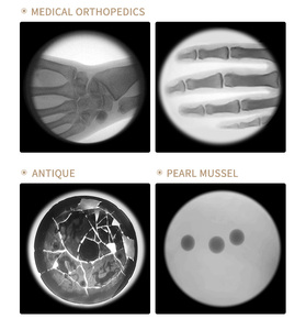 Máquina de rayos X portátil, <span class=keywords><strong>aparato</strong></span> de ultrasonido ortopédico para brazo y pie, fluoroscopia, esqueleto - Product Image 5