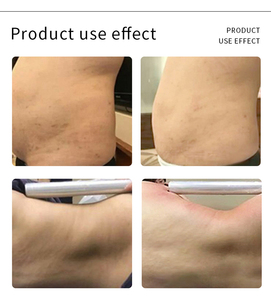 2026 Loss Weight 6-in-1 Beauty Machine Microelectric Therapy for Eye Contour Improvement & Dark Circle Removal - Product Image 4