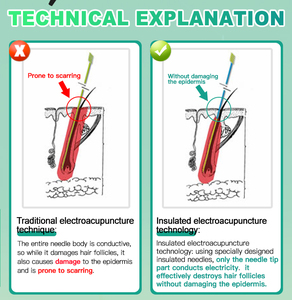 Terbaik 2 in 1 paduan Electrolyze Tweezer profesional pigmen penghapusan terisolasi jarum elektrolisis untuk menghilangkan rambut - Product Image 5