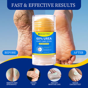 Crema en Barra para Pies con 60% de Urea, Absorción Rápida, Exfoliación Suave, Cuidado de la Piel de los Pies, Eliminación de Piel Muerta, Hidratante, OEM/ODM - Product Image 2