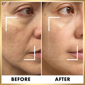 Özel etiket 24k altın Serum cilt bakımı seti kore organik Anti Aging beyazlatma cilt bakımı seti (yeni) toptan - Product Image 4