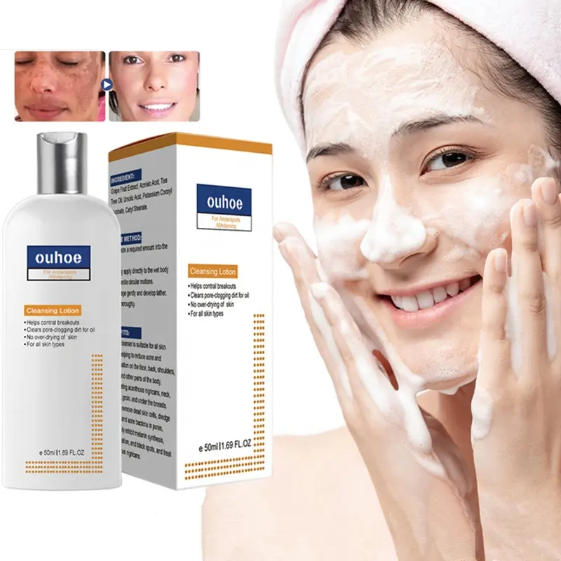 OUHOE 50ml rosto limpeza loção acantose niqricans tratamento acne manchas remoção forte branqueamento loção atacado