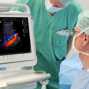 Échographe Doppler Couleur Économique avec Écran Tactile et Fonction PW, Instrument d'Échographie Médicale Vétérinaire et Humaine USG CU06 - Product Image 6