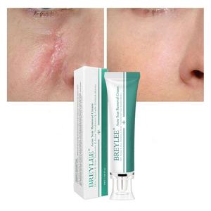 疤痕凝胶面部除疤霜皮肤减轻妊娠纹痕迹修复除疤 - Product Image 4