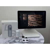Professional Skin Hair Analyzer 50X 200X Hair Health Detector Moisture Tester for Salon Use