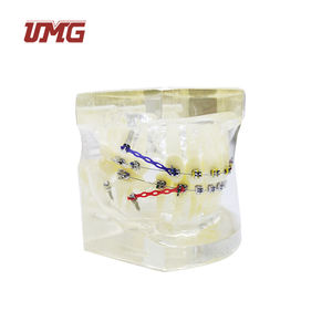 Modelo <span class=keywords><strong>de</strong></span> ortodoncia para entrenamiento Dental, modelo tipodot con soporte <span class=keywords><strong>de</strong></span> Metal transparente para la comunicación <span class=keywords><strong>de</strong></span> los pacientes - Product Image 4
