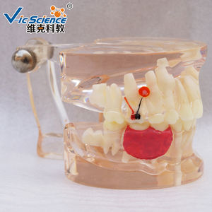 Modelo de Dientes Humanos para Ciencias Médicas, Modelo Patológico de Pérdida Prematura de Dientes Deciduos, Transparente, Mixto con Dientes Faltantes - Product Image 3