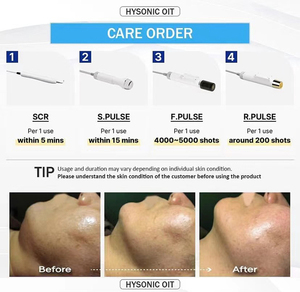 Appareil Anti-Âge 6-en-1 pour Salon : Nettoyage Complet, Hydratation, Raffermissement – Instrument de Beauté Facile à Utiliser et Économique pour Débutants - Product Image 3