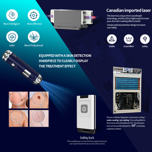 Keslaser เครื่องเลเซอร์ Picosecond ใหม่350PS 532nm 1064 NM ไดโอด Pico เครื่องลบรอย<span class=keywords><strong>สัก</strong></span>เครื่องกำจัดความงาม - Product Image 3