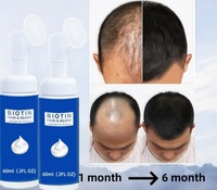 Busa Pertumbuhan Rambut & Jenggot Biotin Label Pribadi OEM 60ml Anti Rambut Rontok Memperkuat Akar Logo Kustom Perawatan Kulit Kepala