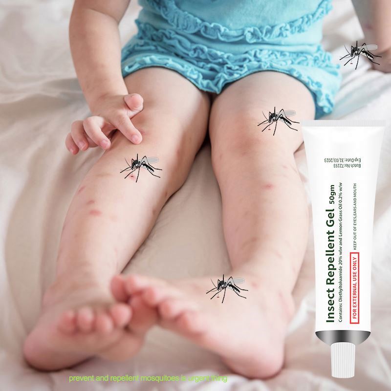 L relieve itching from mosquito bites from sunburn skin wasp sting