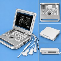 Escáner Veterinario Portátil de Ultrasonido en Blanco y Negro de Alta Resolución con Conectores de Sonda Dual y Batería Integrada para Animales de Granja