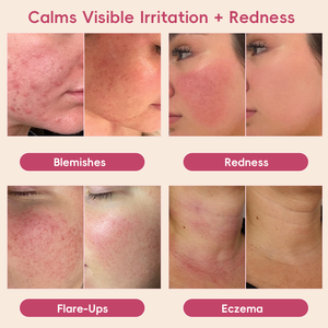 Private Label Professional Care pH Balanced Barrier Repair Anti inflammation Acne Removal Hypochlorous Acid Sensitive Skin Toner - Product Image 5