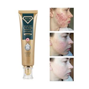 Gel Reparador de Piel Natural TCM de 30g, Venta al por Mayor de Fábrica, Mascarilla para Eliminar Cicatrices y Acné, Ungüento con Arbutina como Ingrediente Principal, Uso Diario - Product Image 1