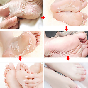 Solución Exfoliante de Alta Calidad con 30% AHA y 2% BHA para Diversos Problemas de Pies, Mascarilla para el Cuidado de los Pies - Product Image 5