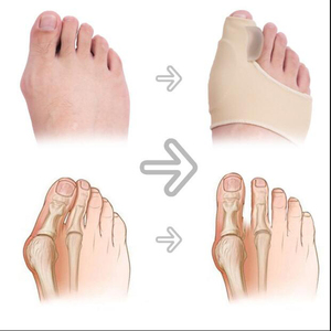 <b>Hot</b> Sale Foot Care Bunion Toe <b>Socks</b> Hallux Valgus Bunion Corrector Big Toe Joint Hammer Toe Separator - Product Image 3