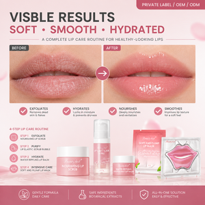 Produits de soin de la peau coréens de luxe en marque privée, soin adoucissant et hydratant pour les lèvres, améliore le teint, coffret de soin pour les lèvres - Product Image 3