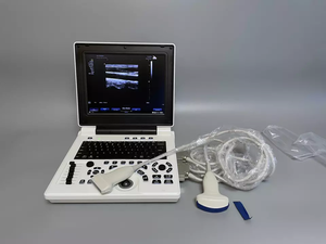 Machine à ultrasons couleur Portable, meilleur <span class=keywords><strong>prix</strong></span> ordinateur Portable couleur Doppler <span class=keywords><strong>Echo</strong></span> Machine pour humain - Product Image 2