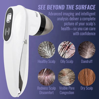 Analyseur de cuir chevelu à balayage en profondeur avec sondes 50X/200X, détecteur de follicules pileux, caméra d'analyse de follicules pileux sans fil WiFi 5G