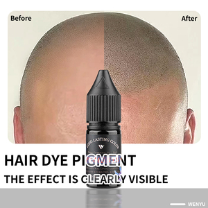 Mực xăm da đầu bán cao cấp OEM WenYu 10ML, kỹ thuật vi điểm da đầu, mực xăm thẩm mỹ vĩnh viễn, mực tạo tóc - Product Image 2
