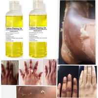 Huile de peeling jaune à étiquette privée, huile de peeling jaune extra forte, exfoliante, blanchissante, pour peaux foncées