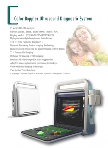 Sistema de Ultrasonido 4D Profesional Rayman con Función Doppler PW CW para Aplicaciones de Cardiología - Product Image 3