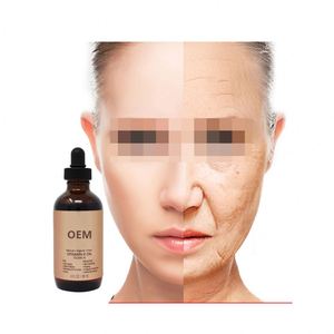 Ingredientes vendidos por Kg Esencia ordinaria Niacinamida 0% Zinc % Aha Arbutina Ácido salicílico 2% Suero - Product Image 1