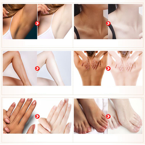 <span class=keywords><strong>โลชั่น</strong></span>บำรุงผิวกายขาวกระจ่างใสสูตรเกาหลี OEM - Product Image 4