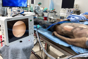 Sistema di Telecamere Mediche Portatili 1080P con Registrazione Video <span class=keywords><strong>per</strong></span> Endoscopia ORL, Ispezione Chirurgica e Artroscopia - Product Image 6