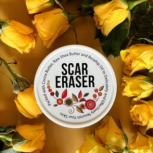 OEM Scar Eraser จางหายไปรอยแผล<span class=keywords><strong>เป็น</strong></span>จากสิวรอยขีดข่วนและรอยแตกลาย | 100% Butters และ Oil สูตรด้วยเนยโกโก้ - Product Image 3