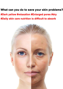 Convenient facial eye cosmetic instrument to lift and pull light lines under the eye bags black eye massager - Product Image 6